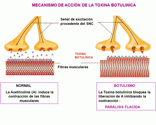 Resultado de imagen de toxina botulÃ­nica gifs